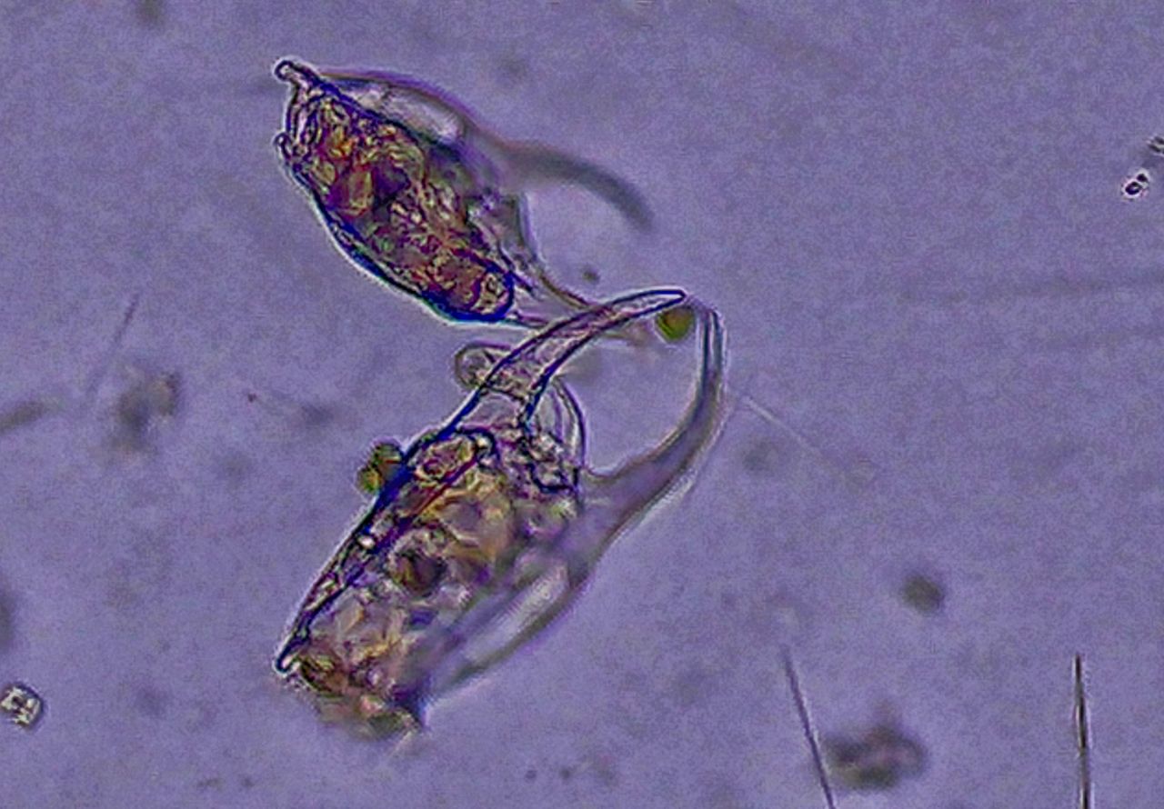 L�ingegnere idrodinamico dello stagno: alla scoperta del rotifero Brachionus